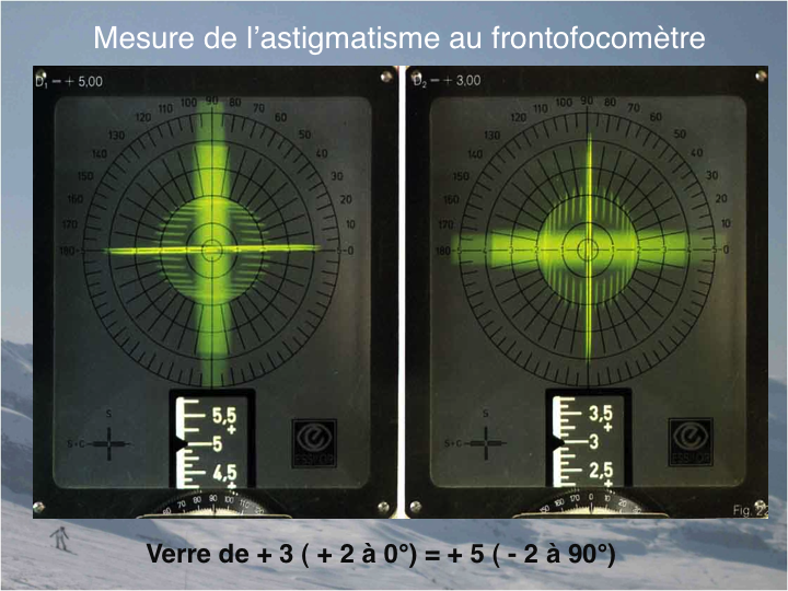 11CR-Astigmatisme11.png