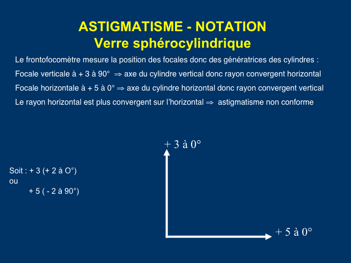 11CR-Astigmatisme12.png