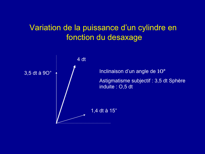 11CR-Astigmatisme14.png