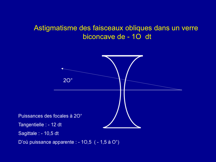 11CR-Astigmatisme34.png