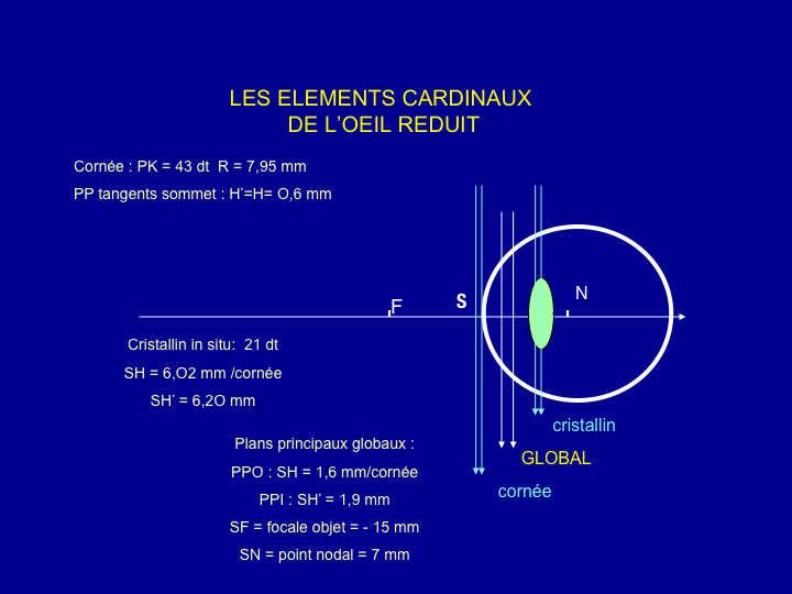 11CR-OptiqueAmetropies14.png