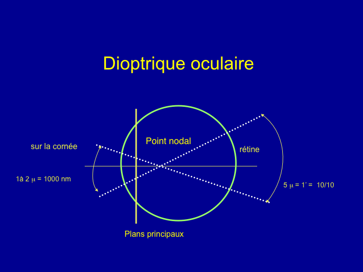 11CR-OptiqueAmetropies16.png