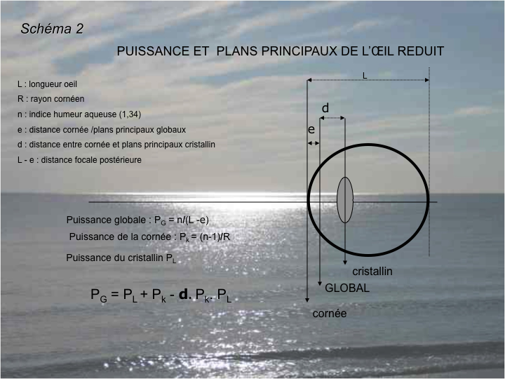 11CR-OptiqueAmetropies42.png