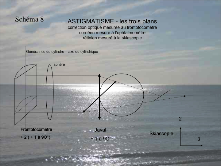 11CR-OptiqueAmetropies45.png