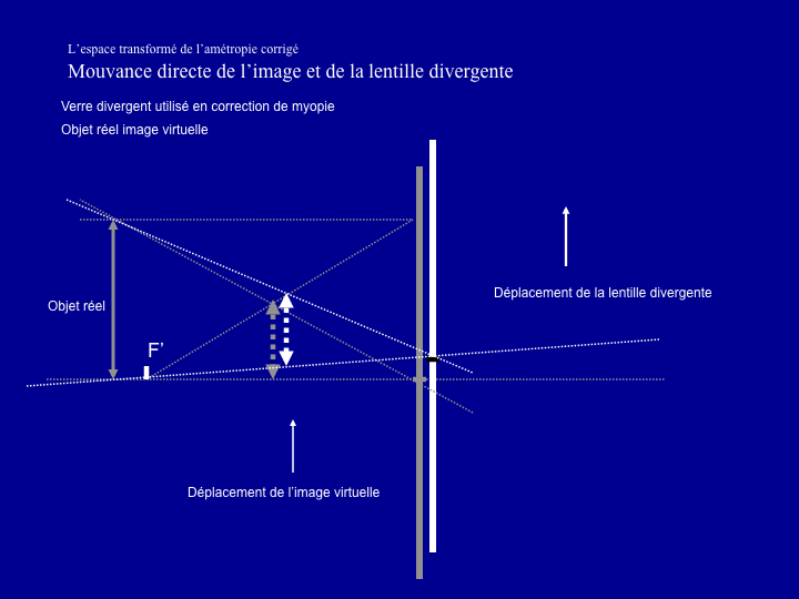 11CR-OptiqueAmetropies55.png