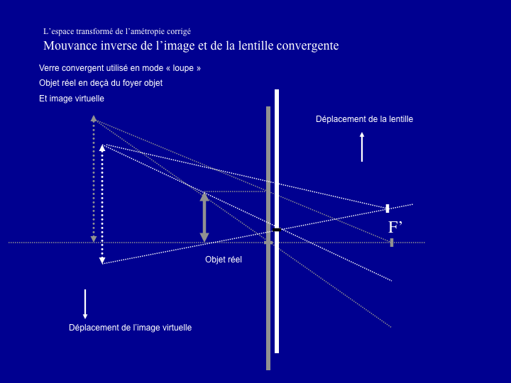 11CR-OptiqueAmetropies57.png