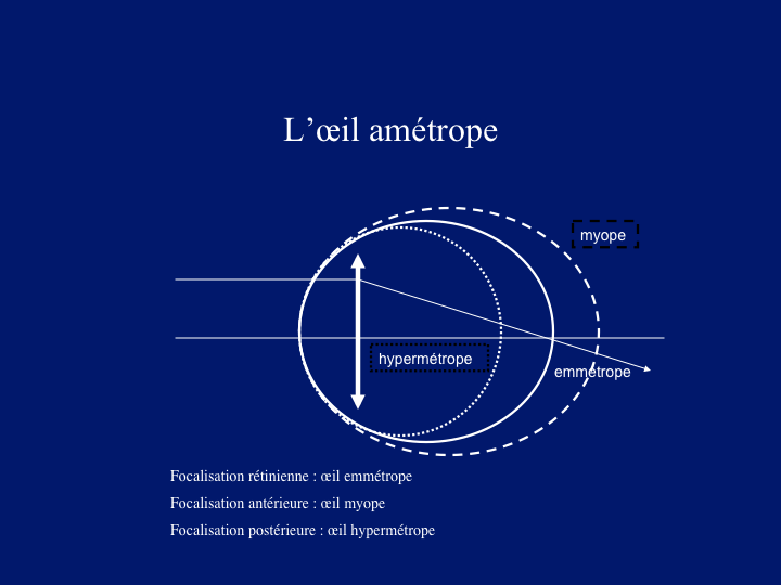 11CR-OptiqueOeil51.png