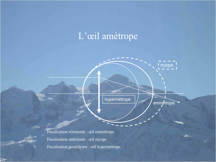 11CR-RappelOptique06.png