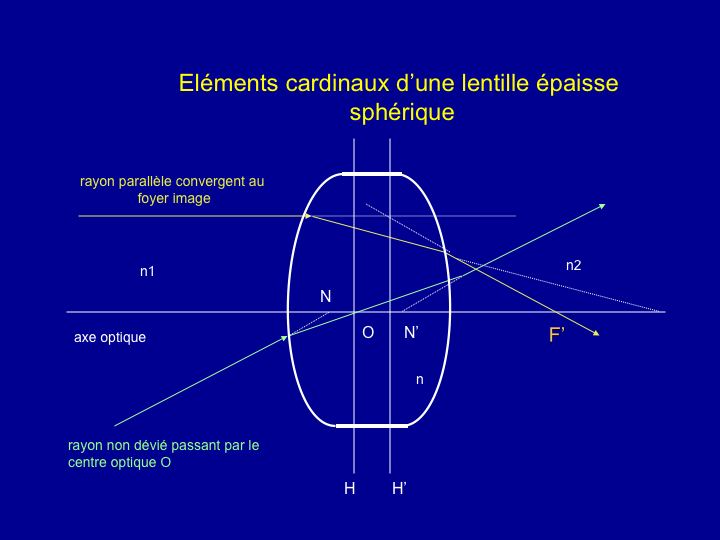 11CR-RappelOptique17.png