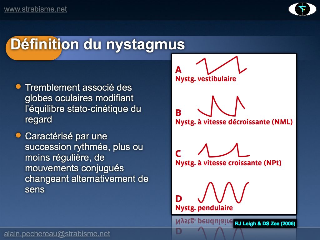 MecaNystagmus.004.jpg